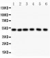 Anti-GFAP Picoband Antibody